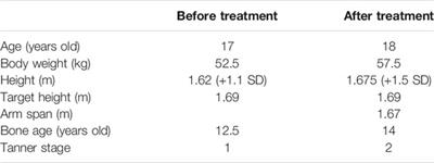 Identification of Novel Compound Heterozygous Variants of the PNPLA6 Gene in Boucher–Neuhäuser Syndrome